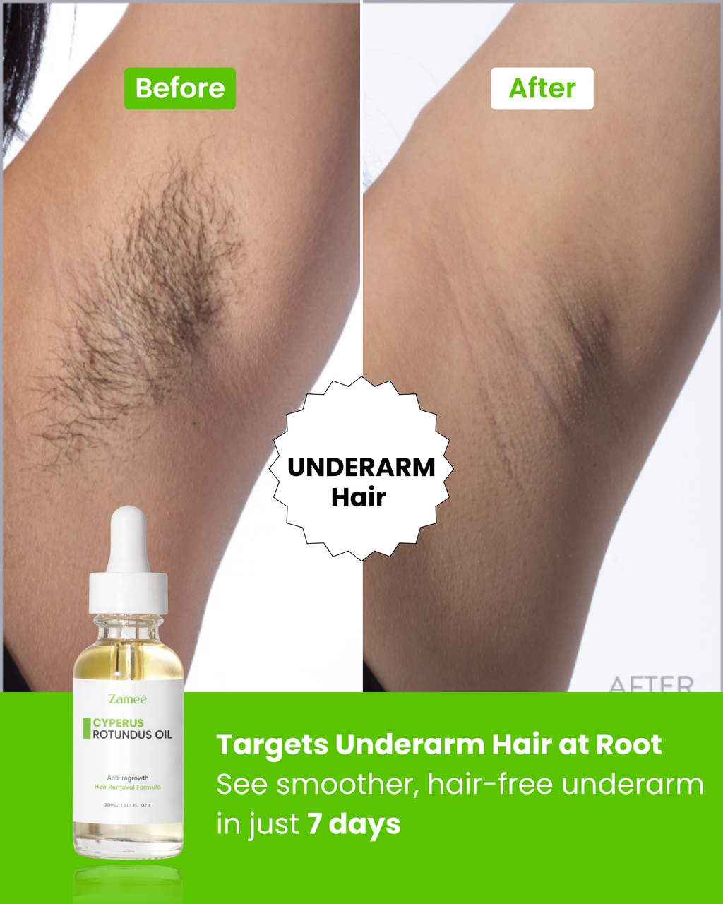 Zamee™ - Cyperus Oil for Unwanted Hair