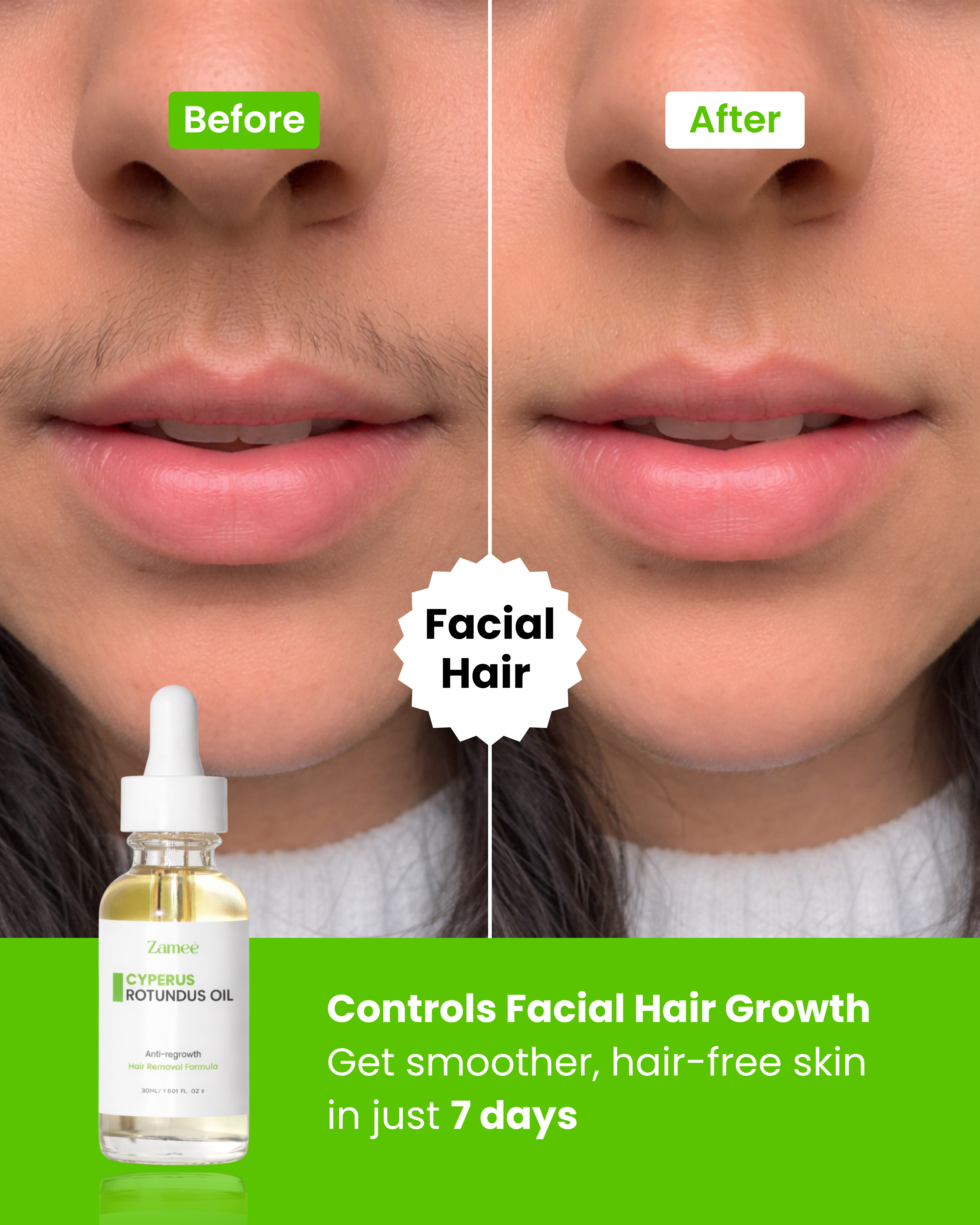 Zamee™ - Cyperus Oil for Unwanted Hair