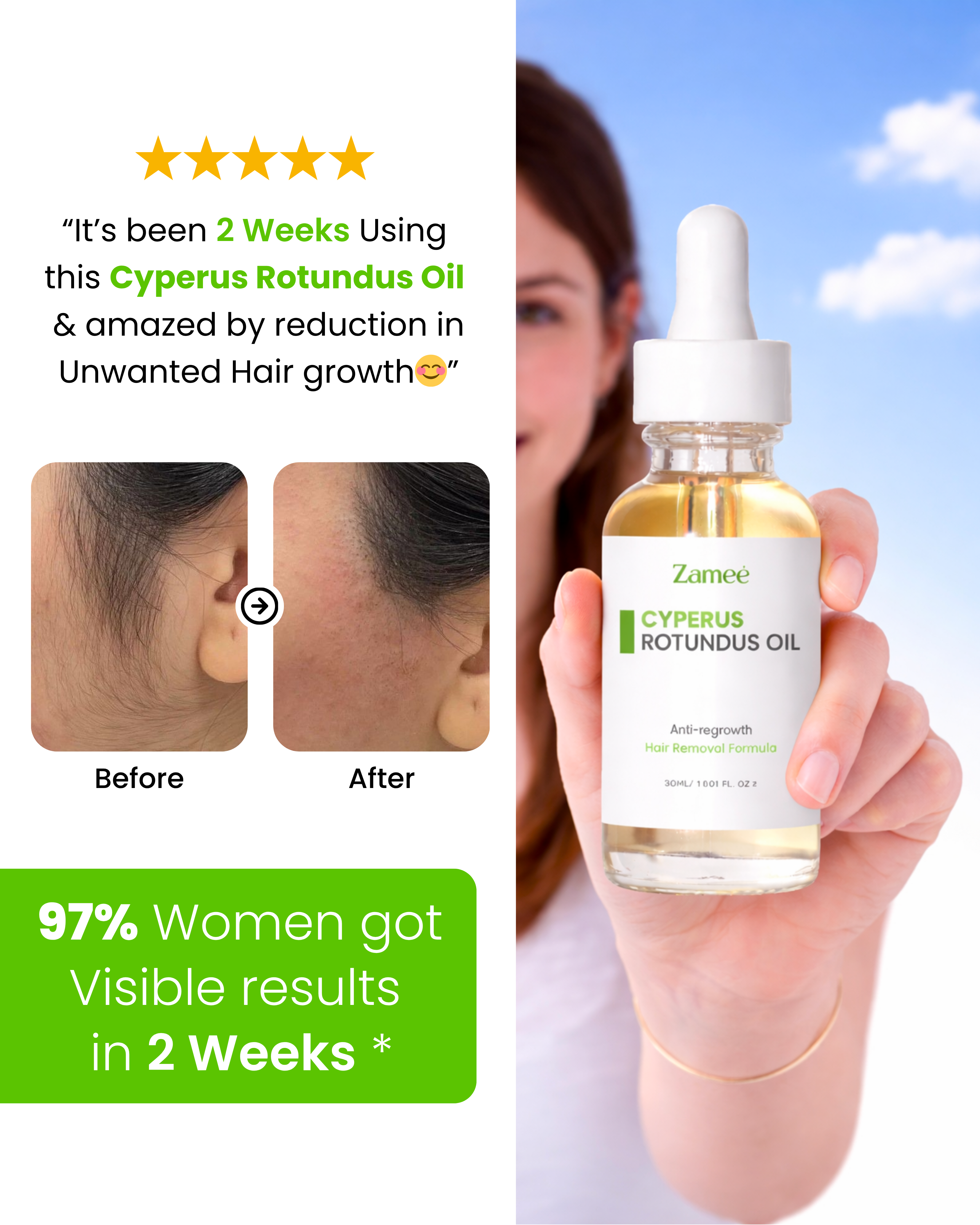 Zamee™ - Cyperus Oil for Unwanted Hair